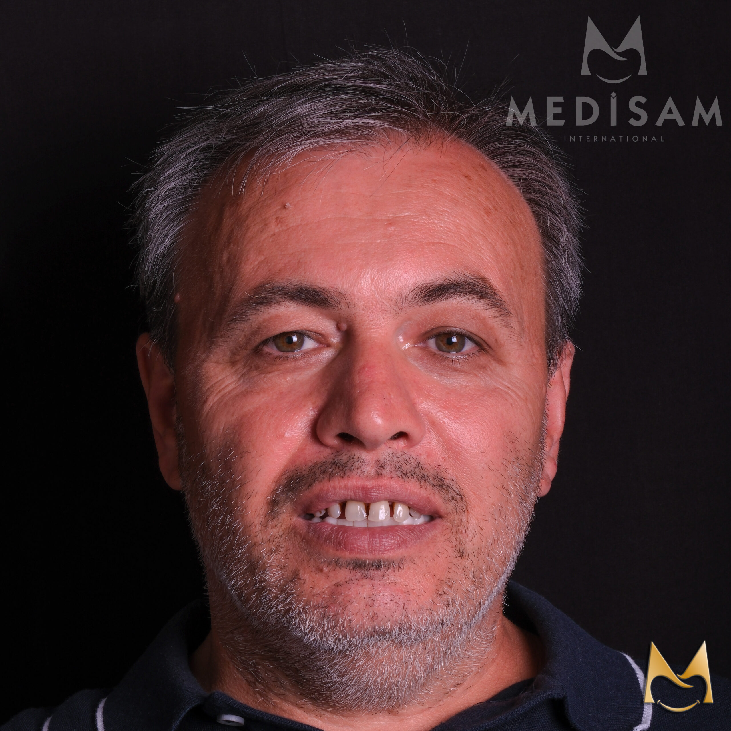 kazım 4