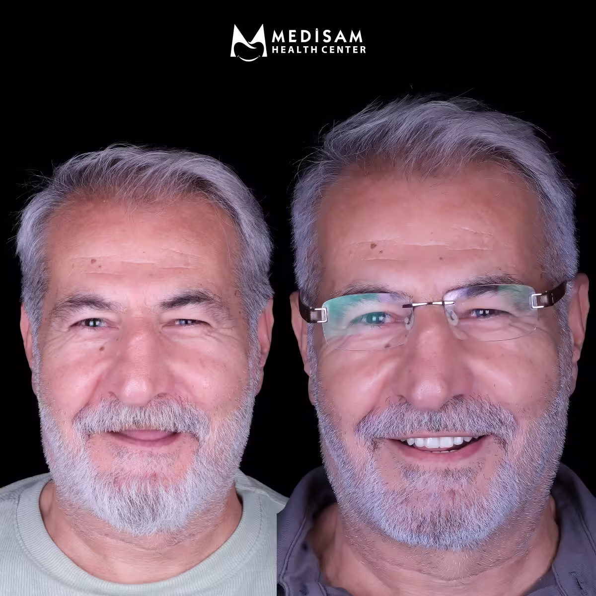 Mehmet Yılmaz #1